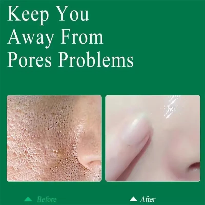 Crème rétrécissante pour les pores à l'acide salicylique, élimine les grands Pores, sérum, élimine les points noirs, répare l'acné, raffermissement, soins pour la peau, cosmétiques