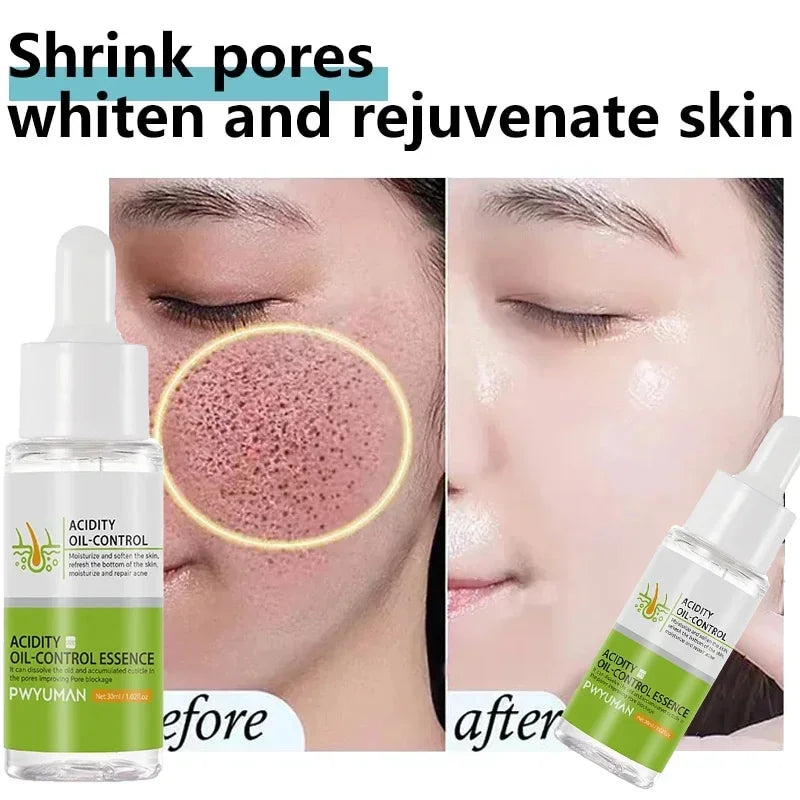 Crème rétrécissante pour les pores à l'acide salicylique, élimine les grands Pores, sérum, élimine les points noirs, répare l'acné, raffermissement, soins pour la peau, cosmétiques