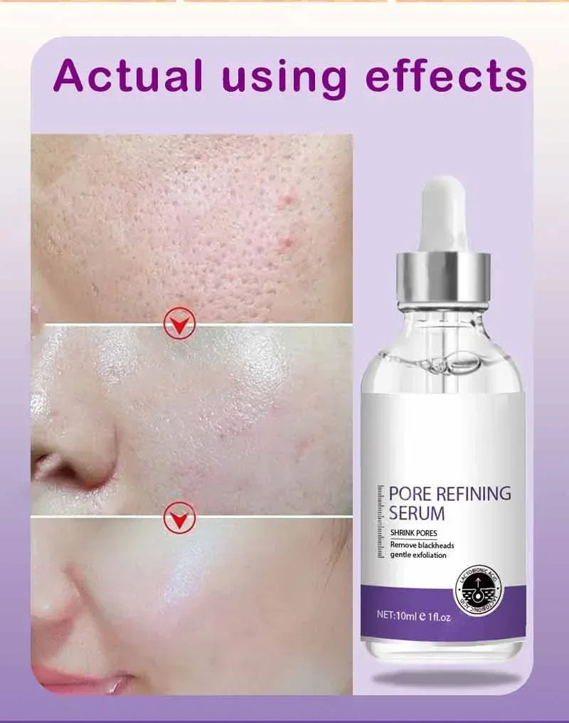 Texture de peau |   Sérum visage éclaircissant pour raffinage des pores, resurfaçage, au rétinol et à la niacinamide non comédogène