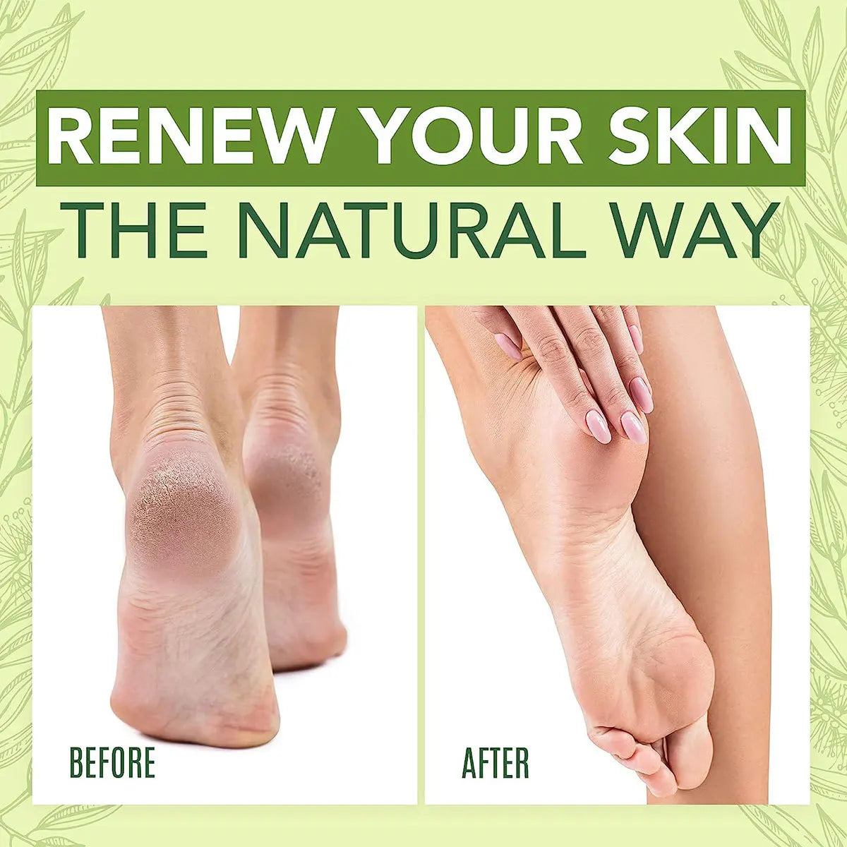 Hydratant pour les pieds à l'huile de Neustrvera et d'arbre à thé pour nourrir en profondeur la peau, pour une peau sèche et rugueuse, soins quotidiens des mains et des pieds