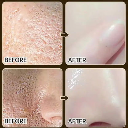 Crème rétrécissante pour les pores à l'acide salicylique, élimine les grands Pores, sérum, élimine les points noirs, répare l'acné, raffermissement, soins pour la peau, cosmétiques