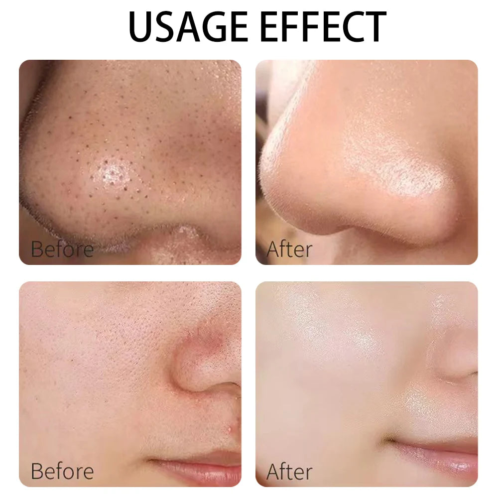 Une variété de masques d'argile, thé vert, curcuma, boue de la mer morte, blanchissant et hydratant, nettoyage en profondeur des pores, contrôle de l'huile et mo