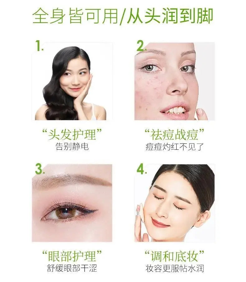 Gel éclaircissant pour la peau, crème anti-acné, gel après-soleil, 260ml