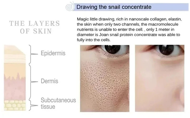 Crème rétrécissante pour les pores à l'acide salicylique, élimine les grands Pores, sérum, élimine les points noirs, répare l'acné, raffermissement, soins pour la peau, cosmétiques