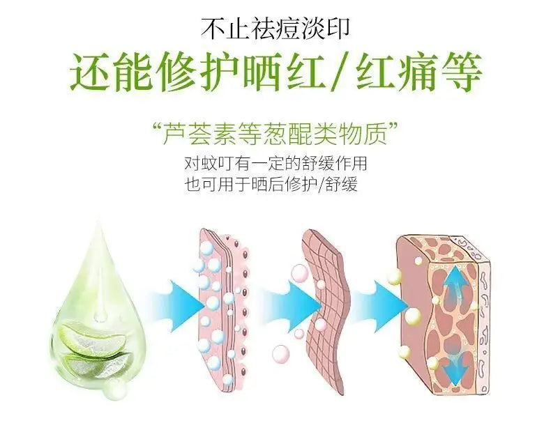 Gel éclaircissant pour la peau, crème anti-acné, gel après-soleil, 260ml