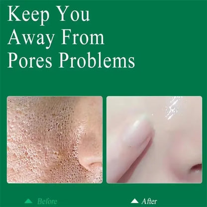 Crème rétrécissante pour les pores à l'acide salicylique, élimine les grands Pores, sérum, élimine les points noirs, répare l'acné, raffermissement, soins pour la peau, cosmétiques