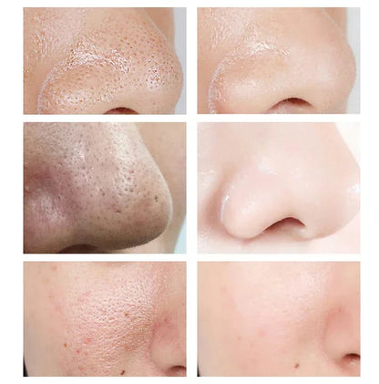 Crème rétrécissante pour les pores à l'acide salicylique, élimine les grands Pores, sérum, élimine les points noirs, répare l'acné, raffermissement, soins pour la peau, cosmétiques