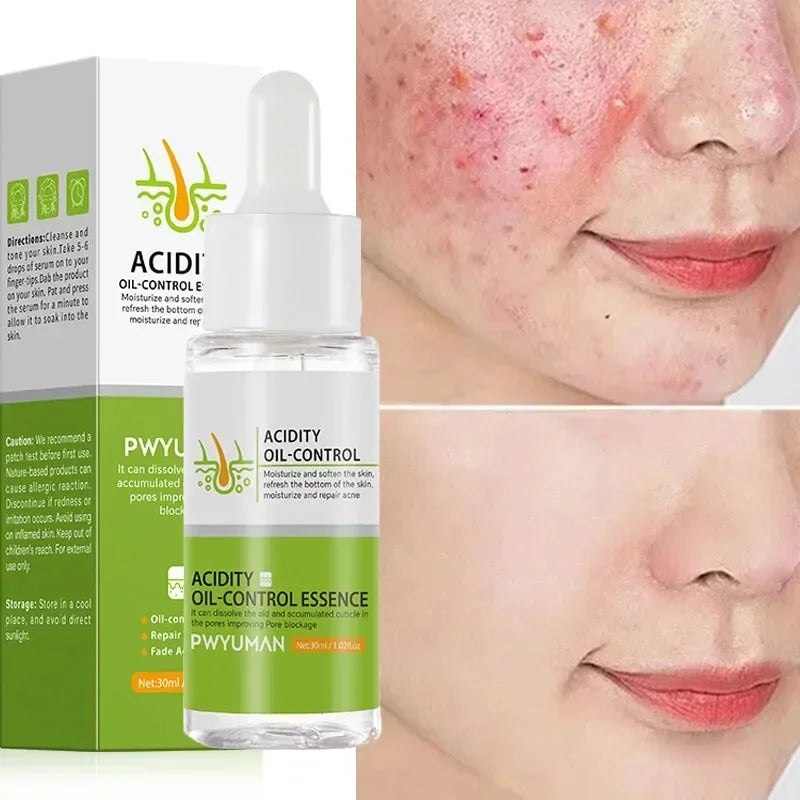 Crème rétrécissante pour les pores à l'acide salicylique, élimine les grands Pores, sérum, élimine les points noirs, répare l'acné, raffermissement, soins pour la peau, cosmétiques