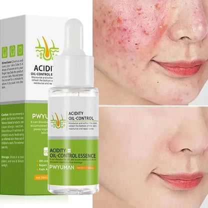 Crème rétrécissante pour les pores à l'acide salicylique, élimine les grands Pores, sérum, élimine les points noirs, répare l'acné, raffermissement, soins pour la peau, cosmétiques