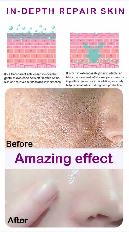 Texture de peau |   Sérum visage éclaircissant pour raffinage des pores, resurfaçage, au rétinol et à la niacinamide non comédogène