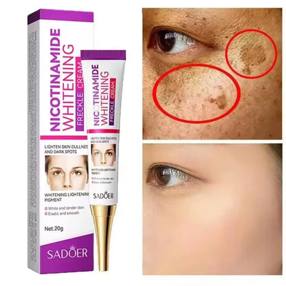 SADOER crème anti-taches de rousseur Nicotinamide crème pour le visage pour Faical hydratant nourrissant hydratant raffermissant crèmes pour le visage