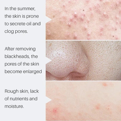 Crème rétrécissante pour les pores à l'acide salicylique, élimine les grands Pores, sérum, élimine les points noirs, répare l'acné, raffermissement, soins pour la peau, cosmétiques